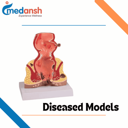 Diseased Models