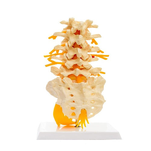 lumbar sacrum spine model with herniated dIsc price