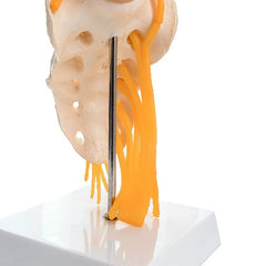 lumbar sacrum spine model with herniated dIsc meddey