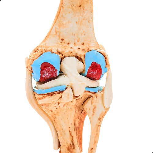knee joint arthritis model meddeygo