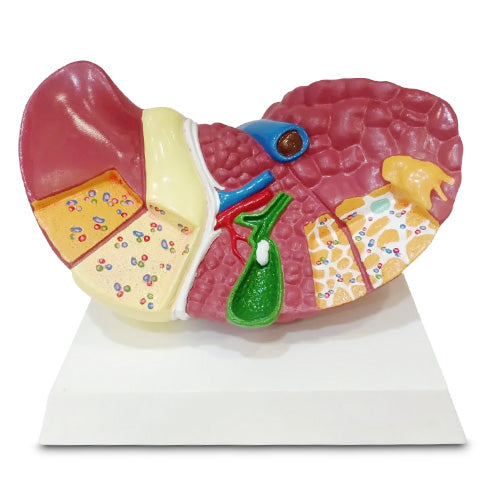 Pathological Liver model