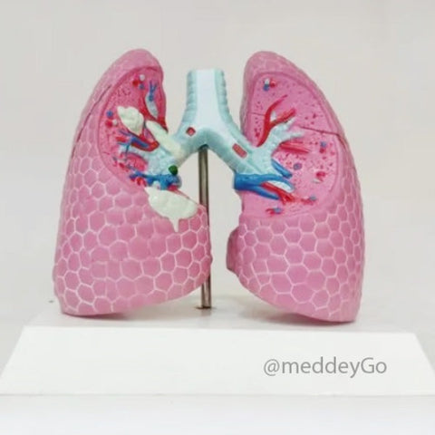 lung pathological model price