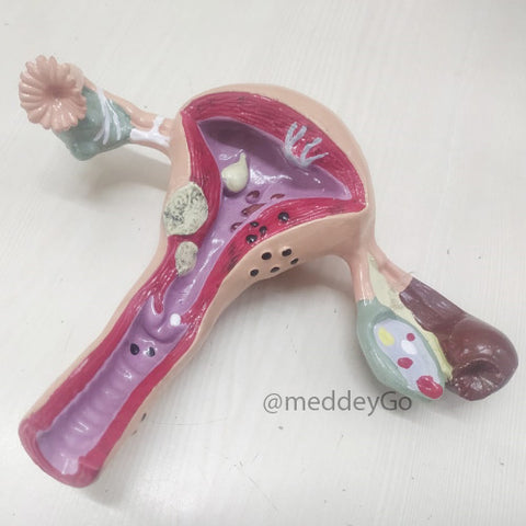 Uterus Anatomical Mode Delux Quality