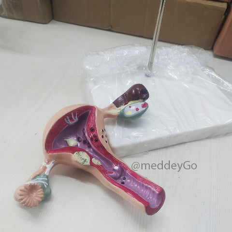 Uterus Anatomical Mode Delux Quality