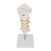 Cervical Spine with Neck Artery and Occipital Bone Model