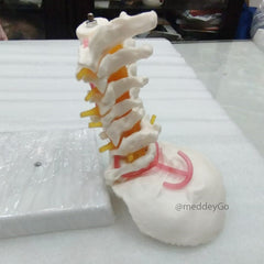 Cervical Spine with Neck Artery and Occipital Bone Model