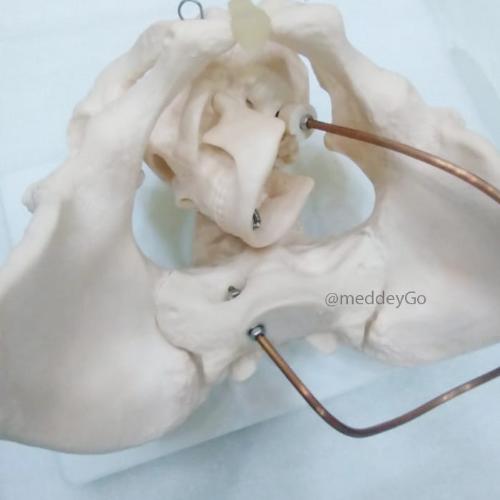 Birth Demonstration Model