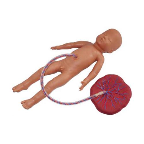 Baby with Placenta and Umbilical Cord