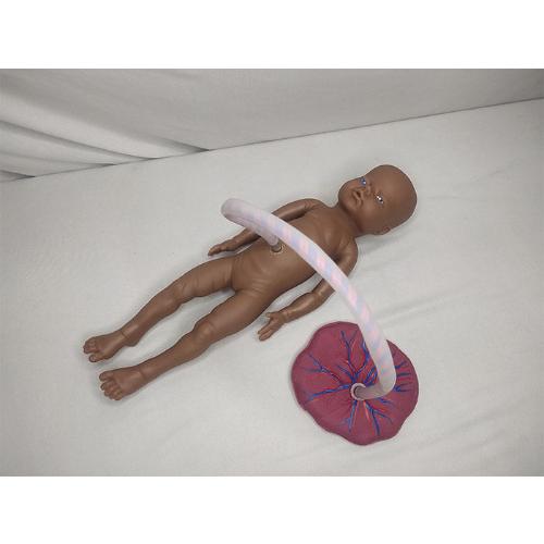 Baby with Placenta and Umbilical Cord