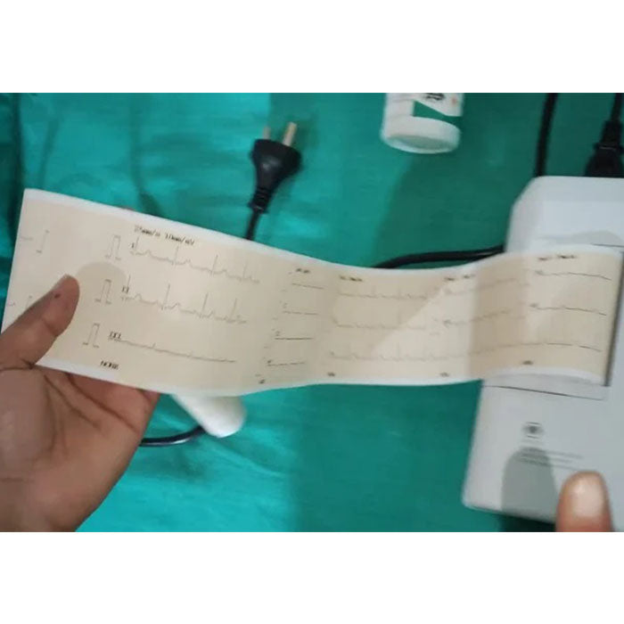 3_channel_ecg_machine
