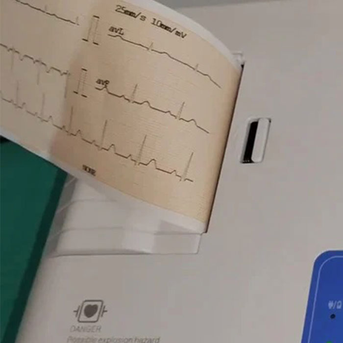 3_channel_ecg