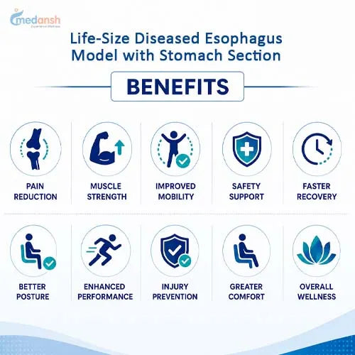 Ddseased esophagus model 