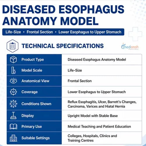 Ddseased esophagus model 
