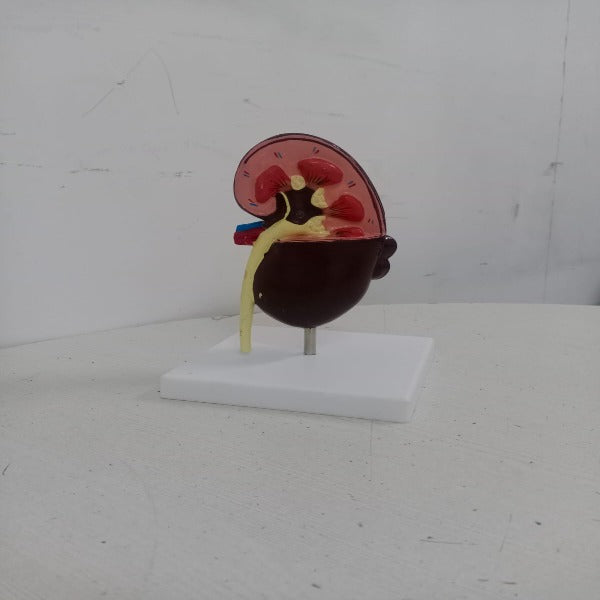 kidney cyst model delux meddeygo