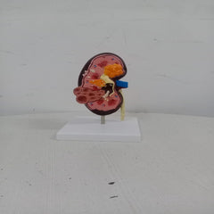 kidney cyst model delux medansh