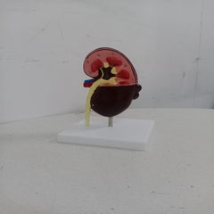 kidney cyst model delux meddeygo