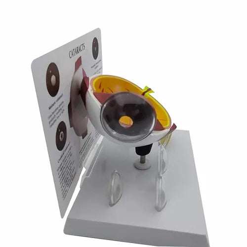 cataract_eye_model