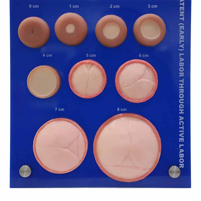 Cervical Dialation Model