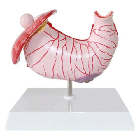 diseased stomach model price
