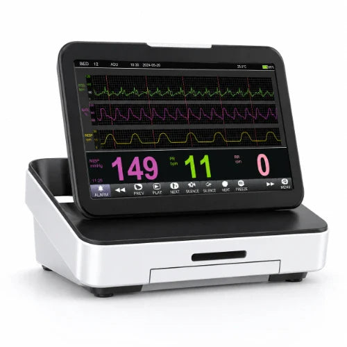 fetal monitor

