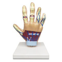 Hand Arthritis Model Delux