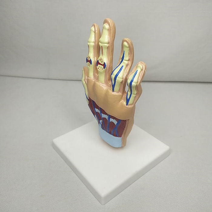 Hand Arthritis Model Delux