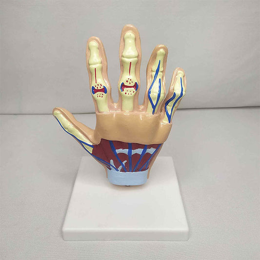 Hand Arthritis Model Delux