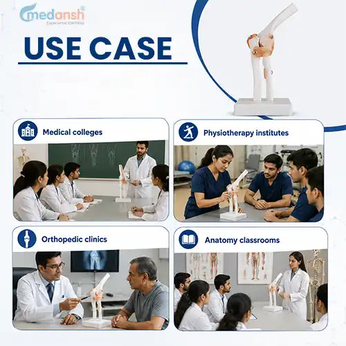 joint model 