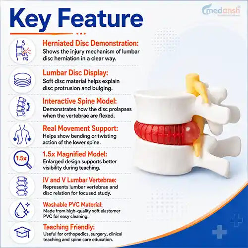 lumbar disc herniation spine