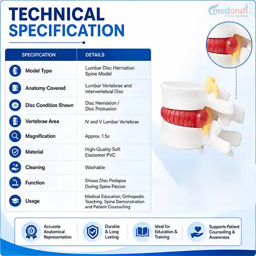 lumbar disc herniation spine