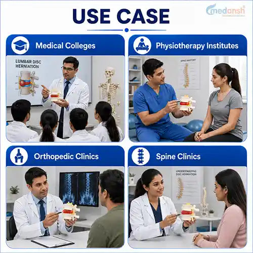 lumbar disc herniation spine