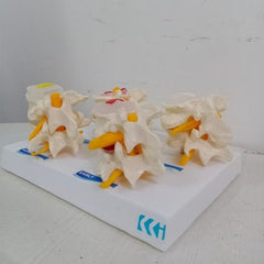 lumbar vertebrae degeneration model medansh