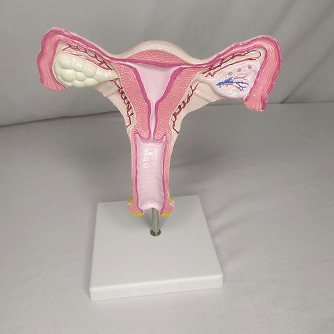 Magnified Uterus Model Delux Quality