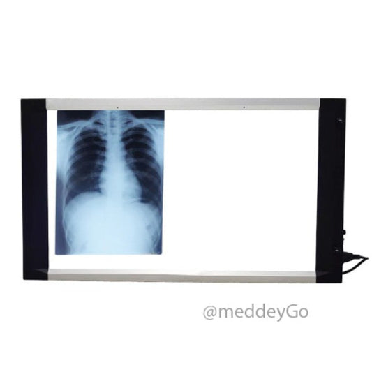 slimLEDxrayviewbox25mmthicknesswithdimmersensor-doublefilmmeddey