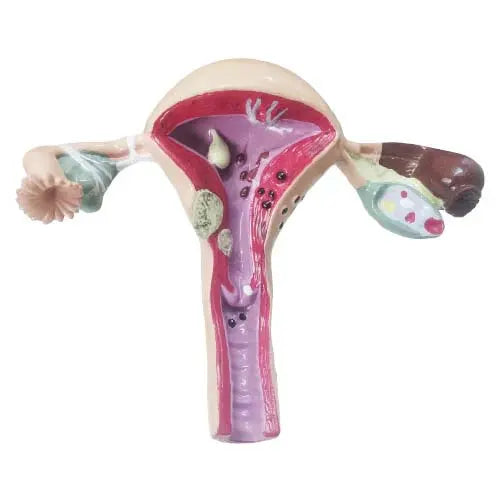uterus anatomical model 