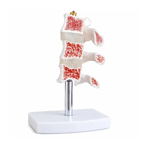 vertebral osteoporosis model
