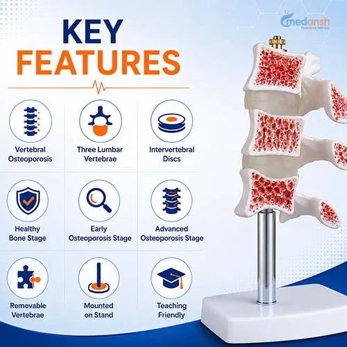 vertebral osteoporosis model
