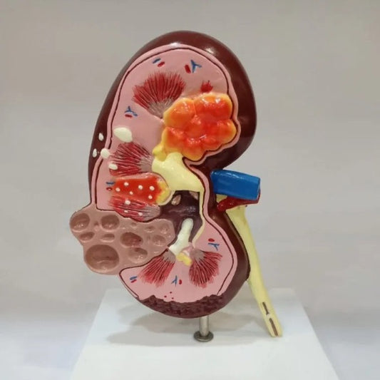 kidney model