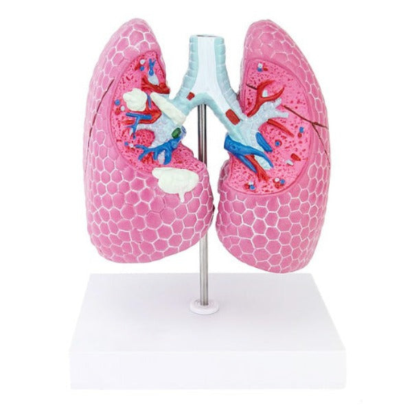lung pathological model meddeygo