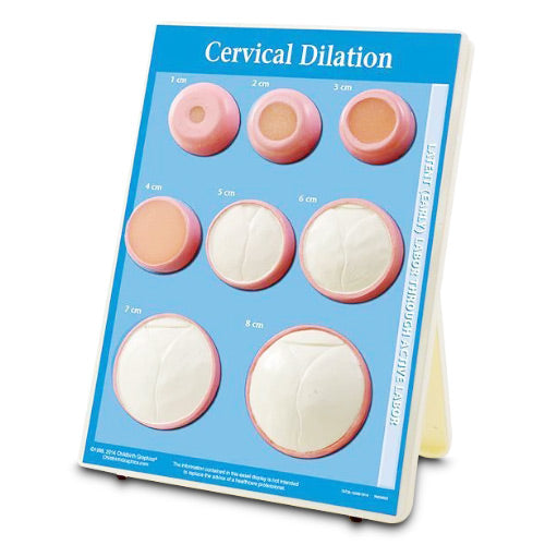 Dilation Model Cervical Dialation Model – Medansh